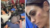 Foto ilustrativa de la nota titulada: Golpean a Alessandra Rojo de la Vega y a funcionarios; acusa a lideresa de comerciantes (Videos)