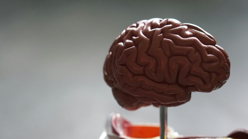 alzheimer-cerebro El cerebro forma neuronas nuevas toda la vida, sostiene estudio - alzheimer-cerebro