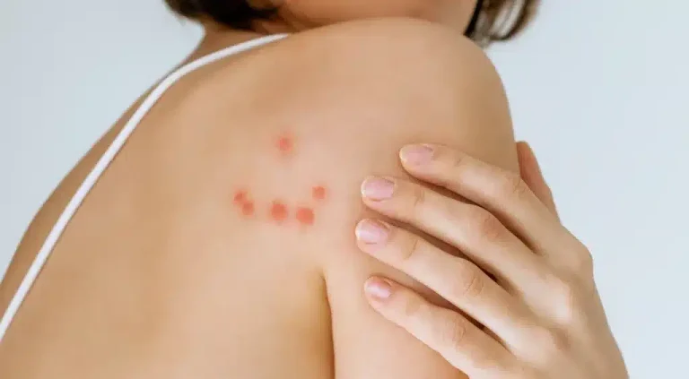 image-108-1024x564-1