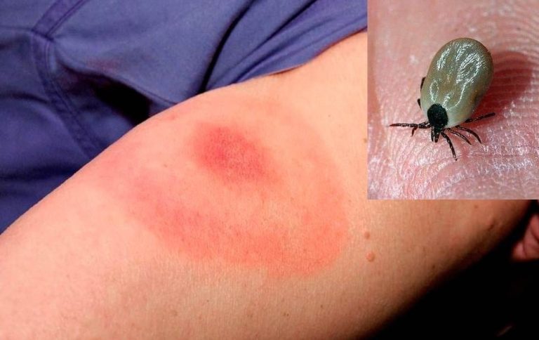 20220808093549400-0-1959489-wbflt7qni-oqk2txtnv