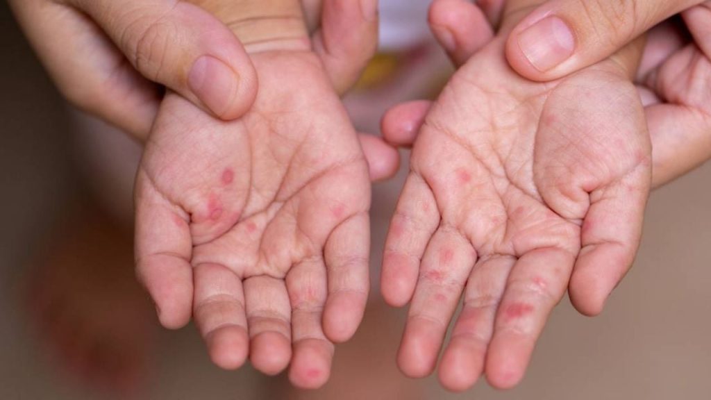 F1280x720 110732 242407